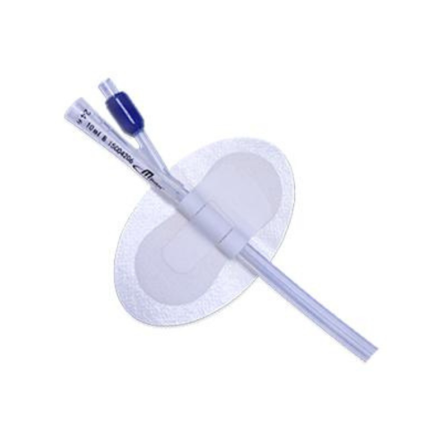 MDevices Catheter Securement Device 6.5 x 10.5cm, Sterile (Each) (630M-M)