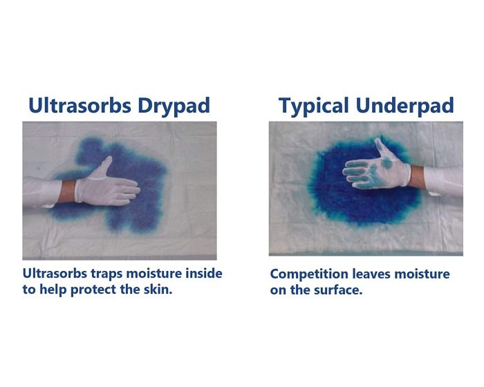 Medline Ultrasorb AP Premium Underpads